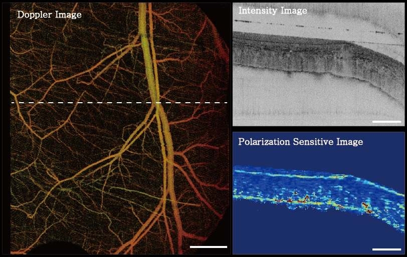 Mouse dorsal skin fold image, 6mm ?7mm ?4mm , color coded by depth,