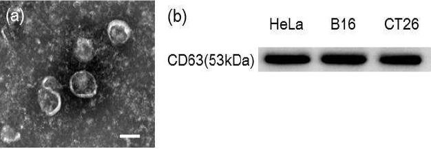 (a) B16F10 엑소좀의 투과전자현미경 사진. Scale bar는 100nm를 나타냄. (b) 여러 암세포에서 분리된 엑소좀들의 western blot 결과