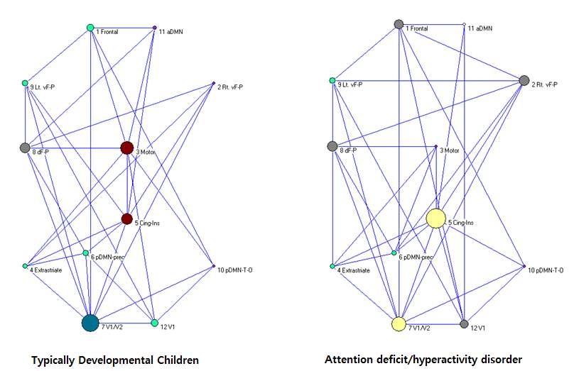 ADHD 아동이 정상아동에 비해 전체적으로 네트워크간 연결성이 더 복잡하고 상대적으로 저하되거나(예를 들어 Rt. vF-P 네트워크) 증가된(예를 들어 CingIns 네트워크) 활동을 보이는 기능적 노드가 관찰됨.