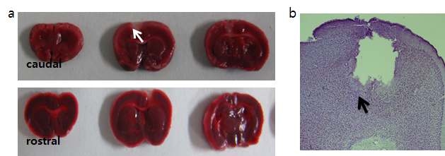 Neuronal loss 24 hours after photothrombosis. Photothrombosis blocks blood supply to the neurons, severe enough to cause neuronal death. (a) Neuronal loss was observed by a negatively stained region by TTC (white arrows). (b) Ischemic core (the eliminated region), penumbral border area (black arrow)