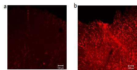 Astrogliosis at 3 hours after stroke induction. Extensive astroglial activation was observed on the photothrombosis site, but not on the contralateral hemisphere. Immunostaining showed little GFAP expression in astrocytes on the contralateral hemisphere (a) but extensive GFAP expression on the photothrombosis site (b).