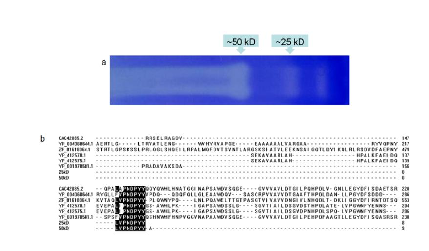 Detection of a protein band with casein-degrading activity (a) and comparative analysis of amino acid sequence of the active protein (b)