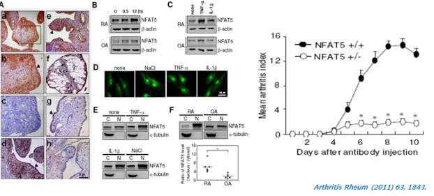 그림. NFAT5의 RA synovium 과발현 및 염증성 사이트카인과의 관계