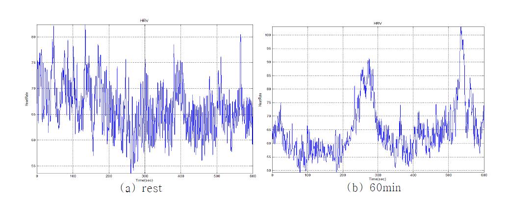 자율신경계 변화에 따른 HRV 변화