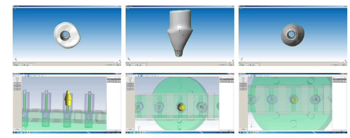 Coustom Abutment 제작