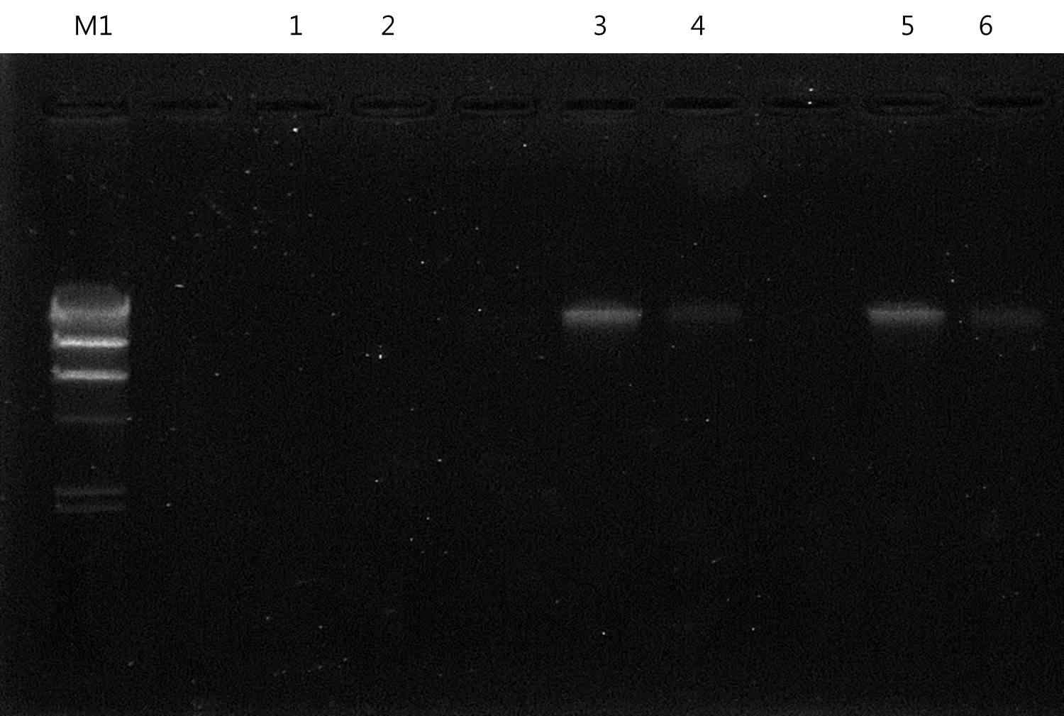 Fig. 24. E. coil & Proteus spp. Bacteriophage의 DNA에 대한 전기영동