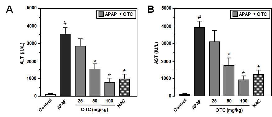 그림 33. APAP가 유도하는 간 독성 마우스 모델에서 혈청 ALT와 AST 활성에 대한OTC의 억제 효과