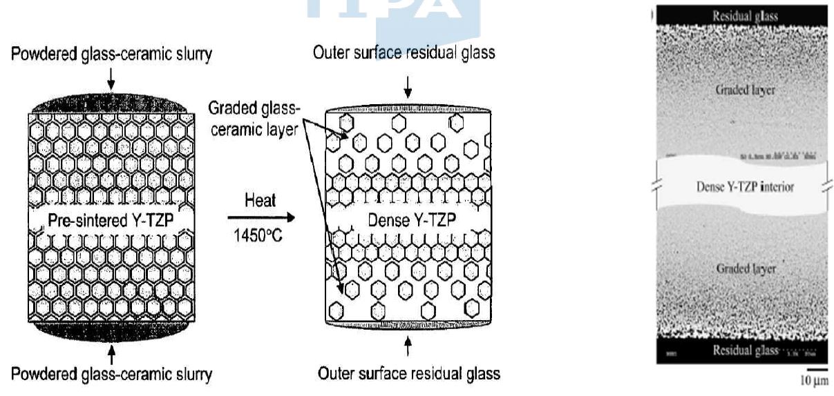 그림 4. 파절저항성이 개선된 functionally graded glass/zirconia/glass 표면