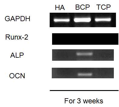 그림6. Osteogenic gene expression of hBMSCs on each scaffold