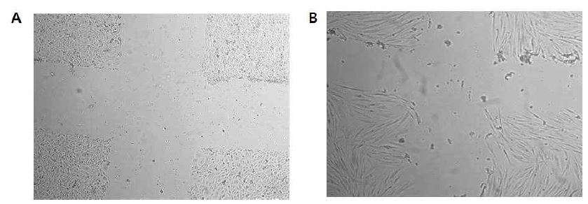 Fig. 11 인간각질형성 세포주와 인간섬유아 세포의 상처자극 직후의 세포현미경 관찰 모습