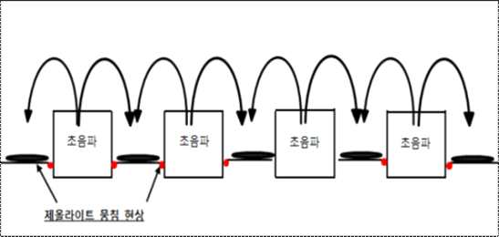 초음파 유닛 부착 방법 ①