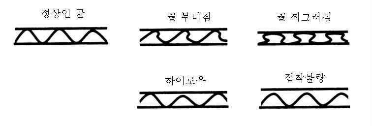 골판지 골의 품질불량 사례