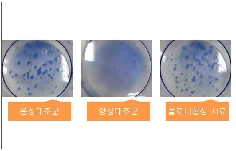 그림 9. 용출물에 의한 콜로니 형성 세포독성 음성 및 양성대조군 시료 관찰 사진