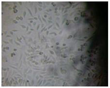 그림 27. 거즈 시험군의 직접법에 의한 세포배양 사진