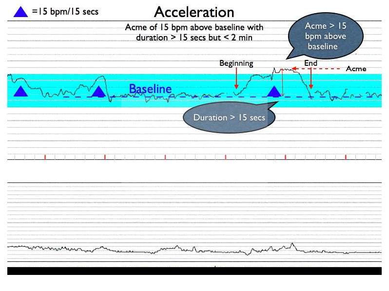 Acceleration count