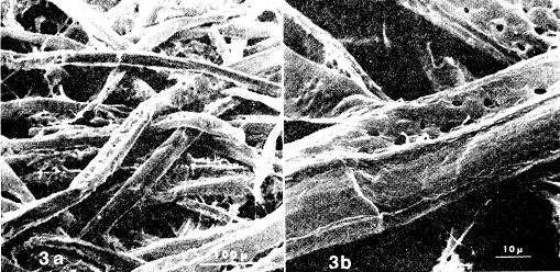 동결건조 시킨 시트 표면의 주사전자현미경 사진