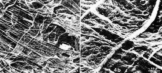 기건 시킨 시트의 표면의 주사전자현미경 사진