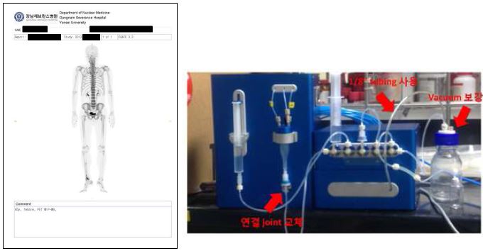 (좌) NaF의 뼈전이암 진단 환자의 PET 영상, (우) 업그레이드 작업을 수행한 자동합성시스템