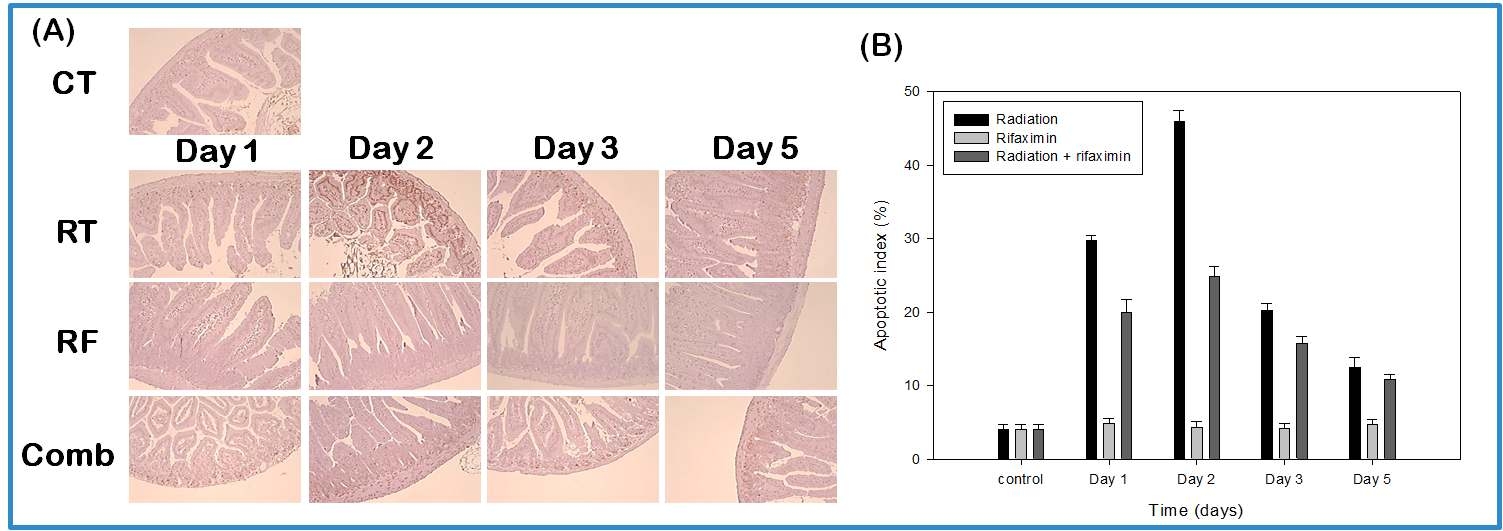 방사선 및 rifaximin을 병행 투여한 후 apoptosis 관찰. Jejunum의 TUNEL stain (A), apoptotic index (B). (CT: control, RT: radiation, RF: rifaximin, Comb: radiation + rifaximin)