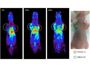 PET imaging of a bilateral NUGC-4 and MKN-45 tumor model after intravenous injection of 64Cu-DOTA-Cetuximab