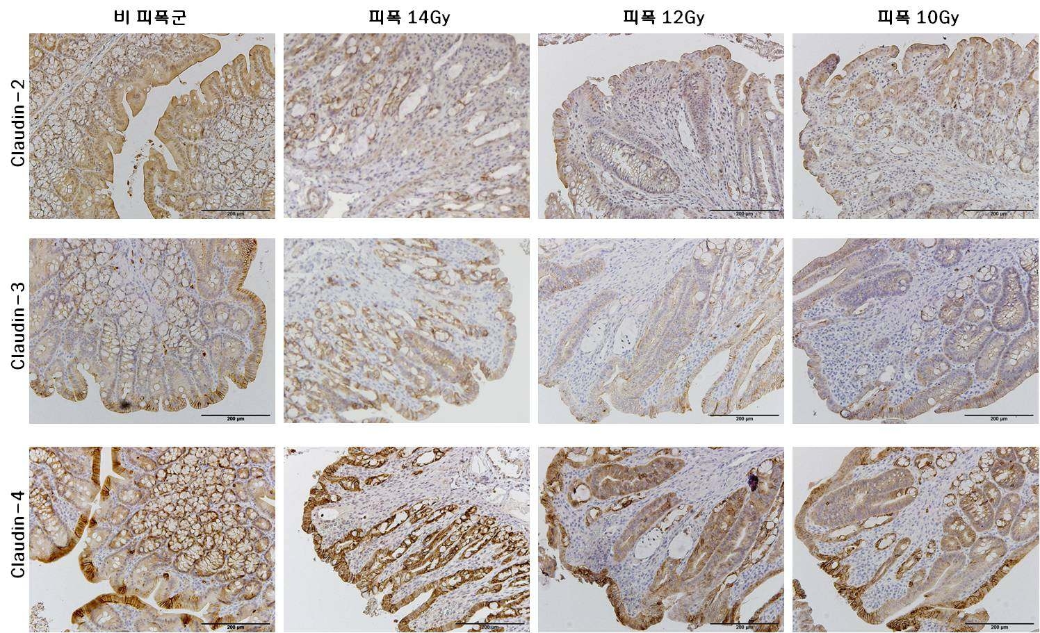 방사선 피폭에 의한 Claudin-2, -3, -4 발현 변화