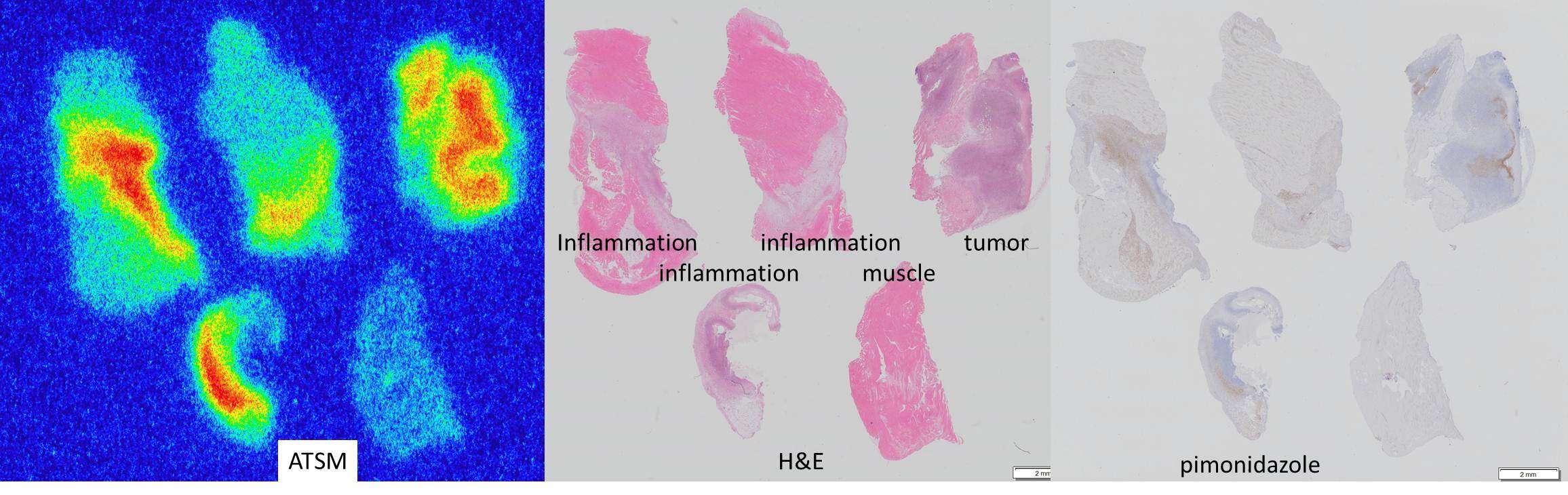 ATSM DRE, H&E, pimonidazole (hypoxia) slide