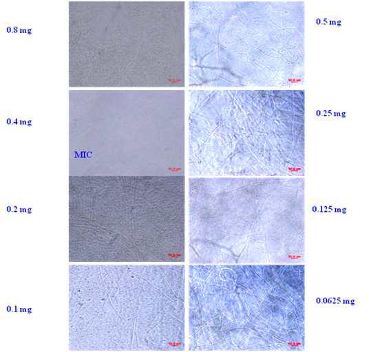 Antifungal activity of purified S. crispa lectin against F. solani under light microscopy.