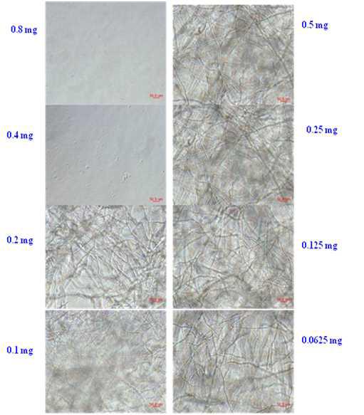 Antifungal activity of purified S. crispa lectin against F. oxysporum underlight microscopy.