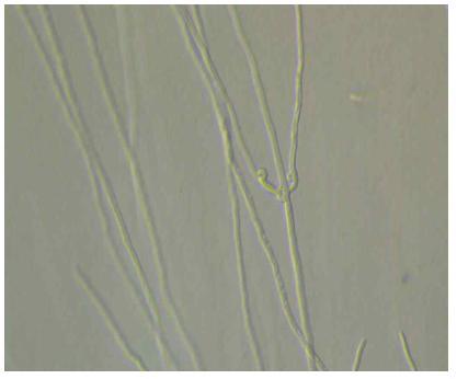 The connecting of clamp and growth of mycelia in PDA media usinginverted microscope