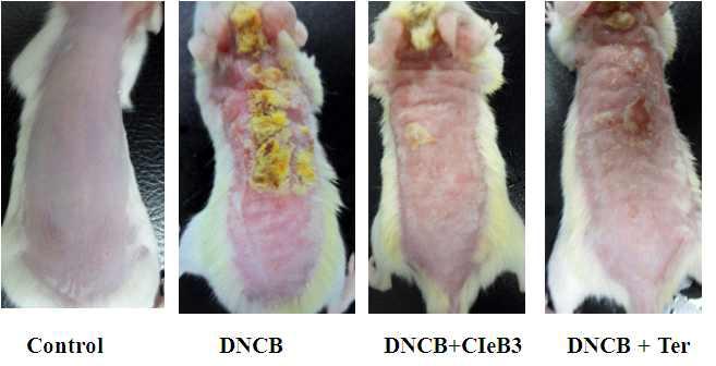 Effects of CIeB3 on the DNCB-induced dermatitis.