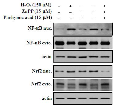그림 99. Pachymic acid의 치수세포에서 산화스트레스에 대한 HO-1 의존적인 항염증작용 기전 -2