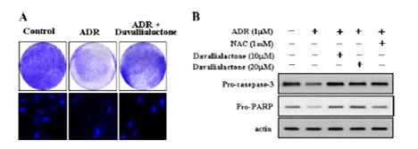 그림 123. Davallialactone의 adriamycin 유도 심장근세포의 apoptosis 억제.