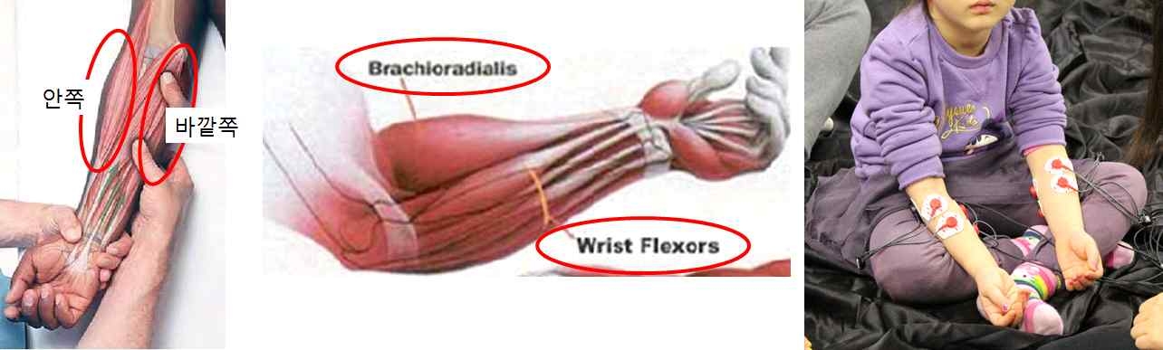 대금EMG 측정 부위: 팔