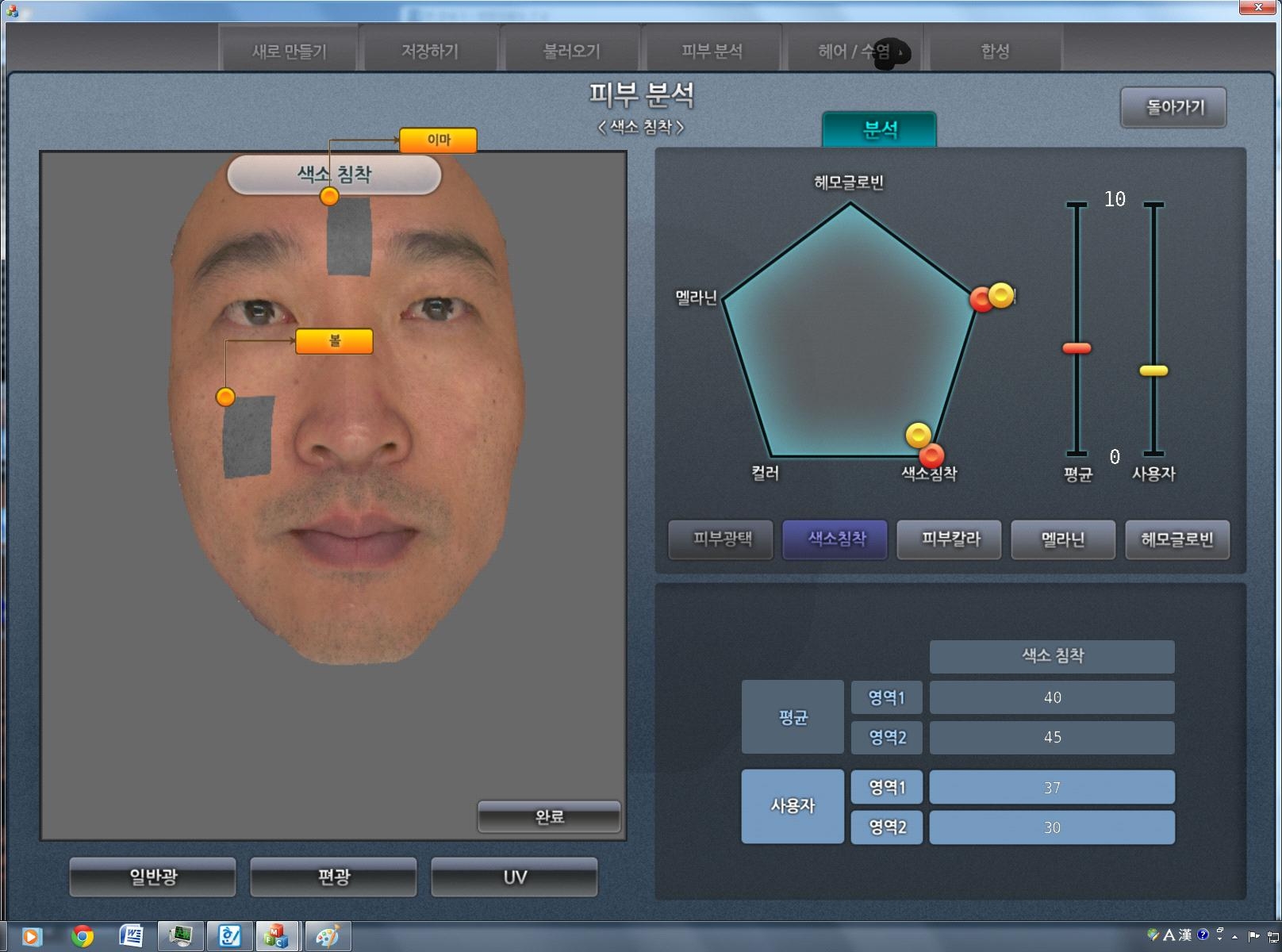 피부 분석 중 색소 침착 분석 결과 GUI