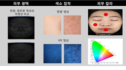 피부 분석 시스템 개념도