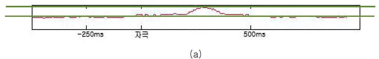 EEG signal power : (a) 고위험 Fz, (b) 일반 Fz