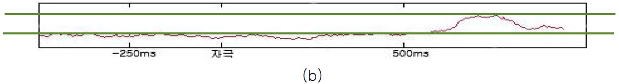 EEG signal power : (a) 고위험 Fz, (b) 일반 Fz