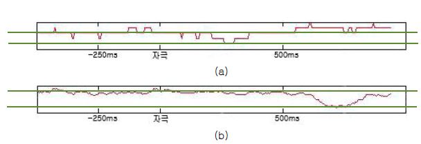 EEG signal power : (a) 고위험 Pz, (b) 일반 Pz