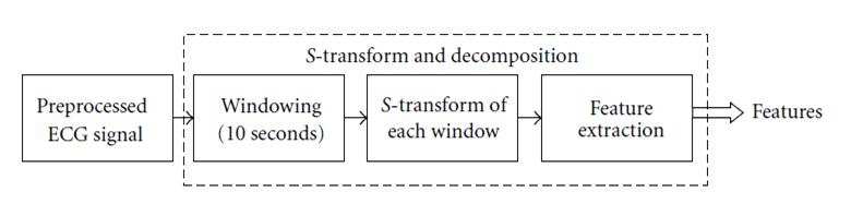 ECG Preprocessing Steps