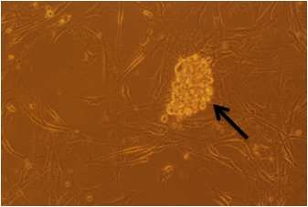 PTD- 전사단백질 도입에 의한 사람유도만능줄기세포 제작