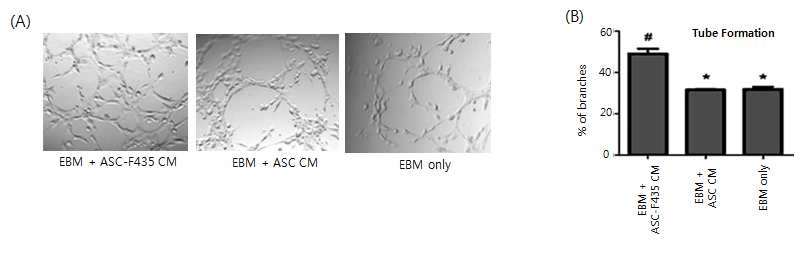F435 형질전환 지방줄기세포에 의한 HUVEC 세포의 tube formation 형성능 증가