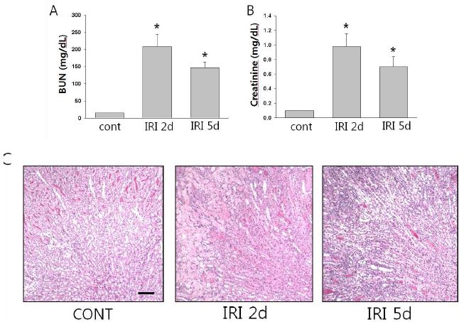 Blood urea nitrogen (A) and serum creatinine levels (B) after IRI in immunodeficient nude mice. Blood and tissue sample were collected 2 and 5days after IRI. (C) Sections of kidney were stained with periodic acid- Schiff after IRI operation. The IRI kidneys showed marked injury with sloughing of tubular epithelial cell, loss of the brush border, and dilatation of the tubules. scale bar, 50um.