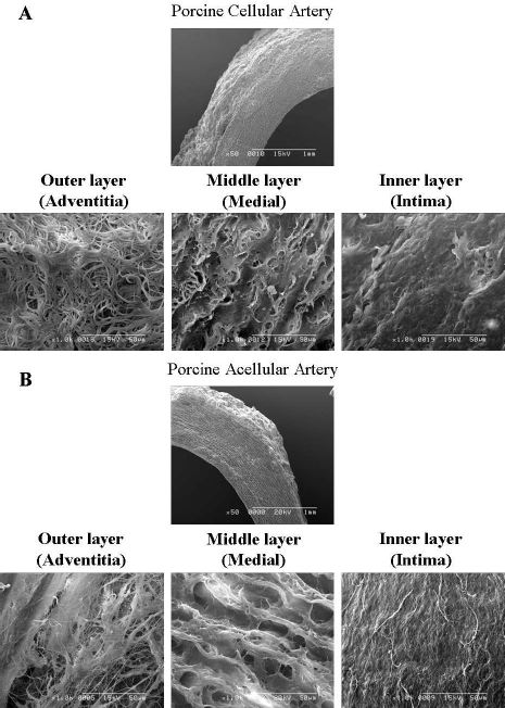 SEM images of porcine cellular artery (A) and acellular artery (B)