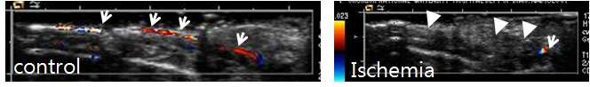 Findings of Doppler ultrasonography in control and hind limb ischemic model. Arrows indicate normal femoral arterial flow and arrow heads indicate no Doppler signals in femoral artery.