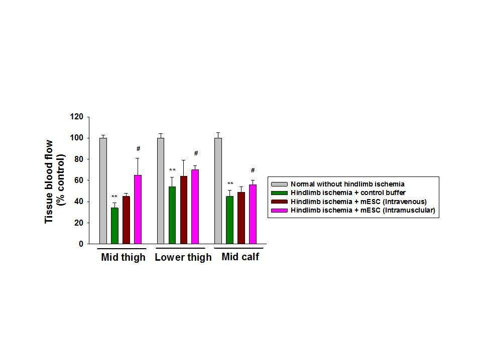 Tissue blood flow in left lower limb was measured with laser- Doppler ultrasonography 7 days after hindlimb ischemia. Male mice (8 weeks old) were anesthetized with ketamine. Left inguinal lesion was dissected with animal microscopy (50X). Left common femoral artery was ligated with silk (4.0) 1 cm apart and femoral artery was excised between ligation. mESCs were injected to mouse by tail vein (2X106 cell). Mice were injected in 3 places with mESC. Injections were applied as follows: 1x106 labeled cells were intramuscularly injected in mid portion of thigh, in lower portion of thigh and in calf area. Measurement was performed from mid portion and lower portion of thigh and mid portion of leg of mice. Data are means?SD. n=4 in each group. * * , vs normal without ischemia; # , vs hindlimb ischemia + control buffer