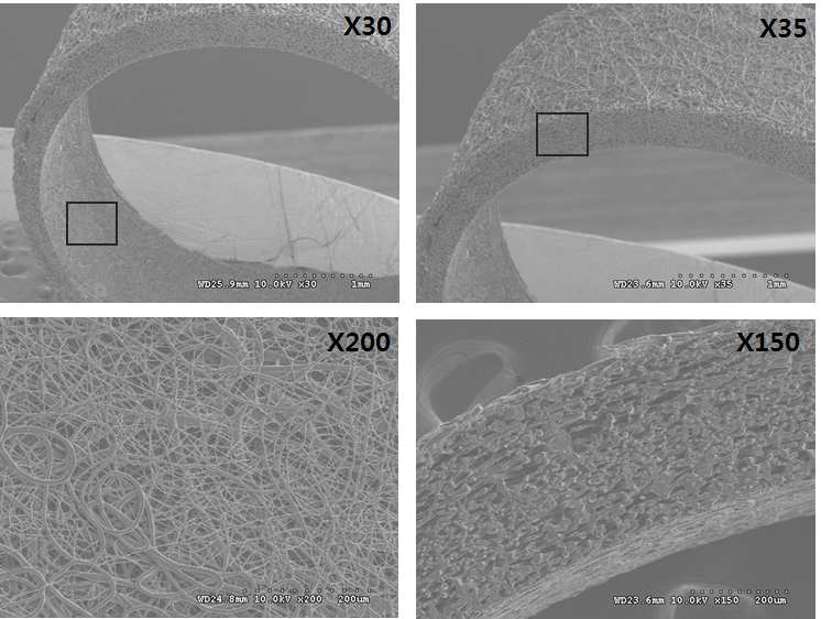 FE- SEM images of a PLCL tubular scaffold with different magnification