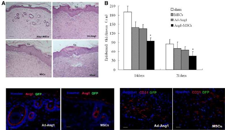 Angiopoietin-1 과발현 중간엽줄기세포의 wound healing 효과를 epidermis 재생과 CD31(+) 세포의 형성정도로 분석함.
