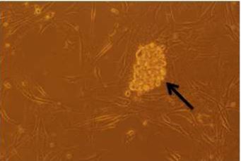 PTD- 전사단백질 도입에 의한 사람유도만능줄기세포 제작