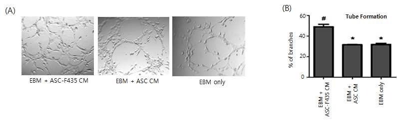F435 형질전환 지방줄기세포에 의한 HUVEC 세포의 tube formation 형성능 증가 (A) Matrigel에서의 tube formation 형성능 분석 (B) branches 형성정도에 대한 정량분석 CM: conditioned media