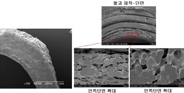 왼쪽 사진은 native 돼지 혈관의 SEM 단면 사진. 오른쪽 사진은 세포가 부착된 fiber sheet를 이용하여 튜브 모양으로 제작한 인공 혈관의 단면 사진. 확대된 이미지에서 단면은 fiber 형태로 되어있음을 확인할 수 있고, 면과 면 사이에 세포가 부착되어 있음을 확인할 수 있음.